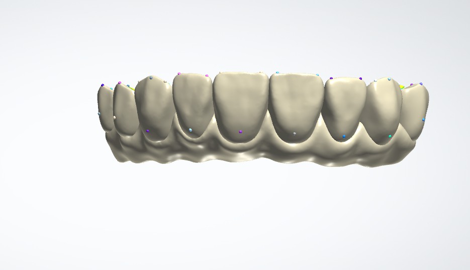 Cat design master's Gingival Porcelain design daily case.