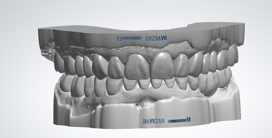 Diagnostic wax design from Dan.